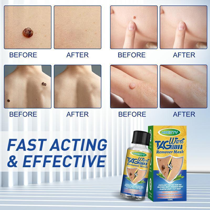 Herbal Facial Mole Removal Solution