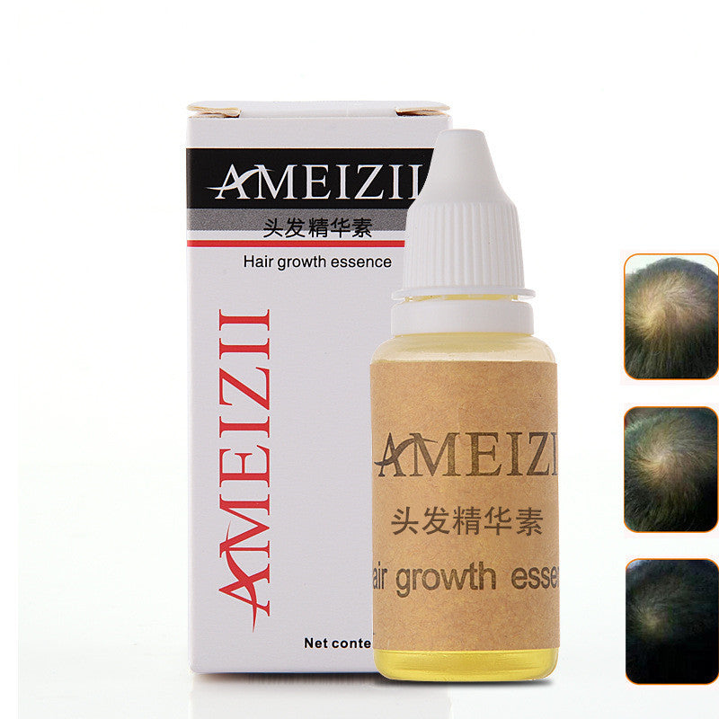 Foreign Trade Explosion Model Unisex Ameizii Hair Ginger Shampoo Care