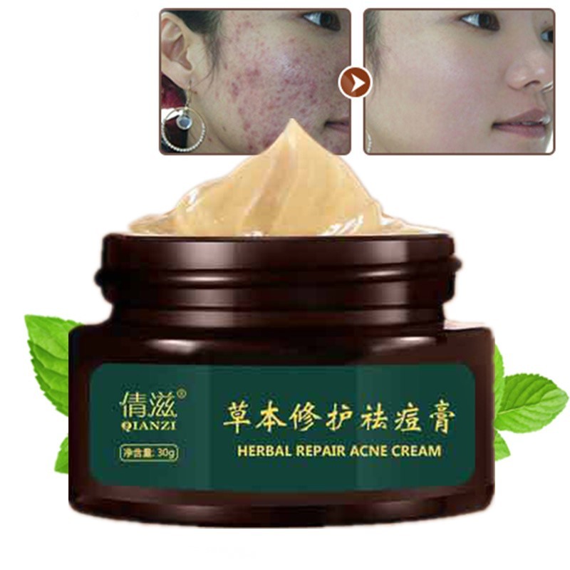 Herbal Repair And Reduce Acne Marks And Acne Cream