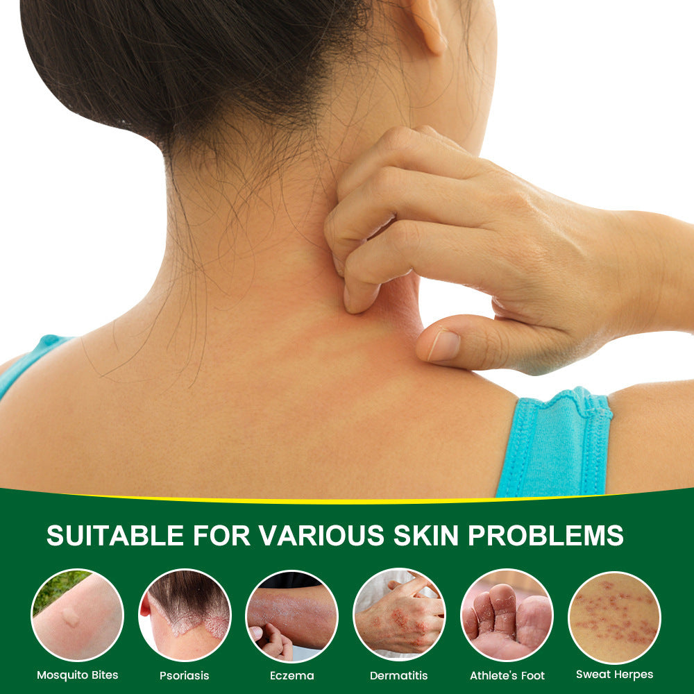 Herbal Anti-itch Skin Care Cream