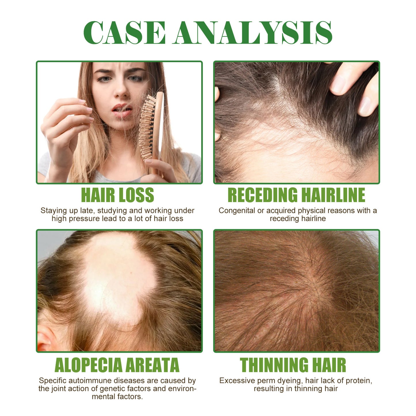 Rosemary Hair Care Essential Oil Repair Damage