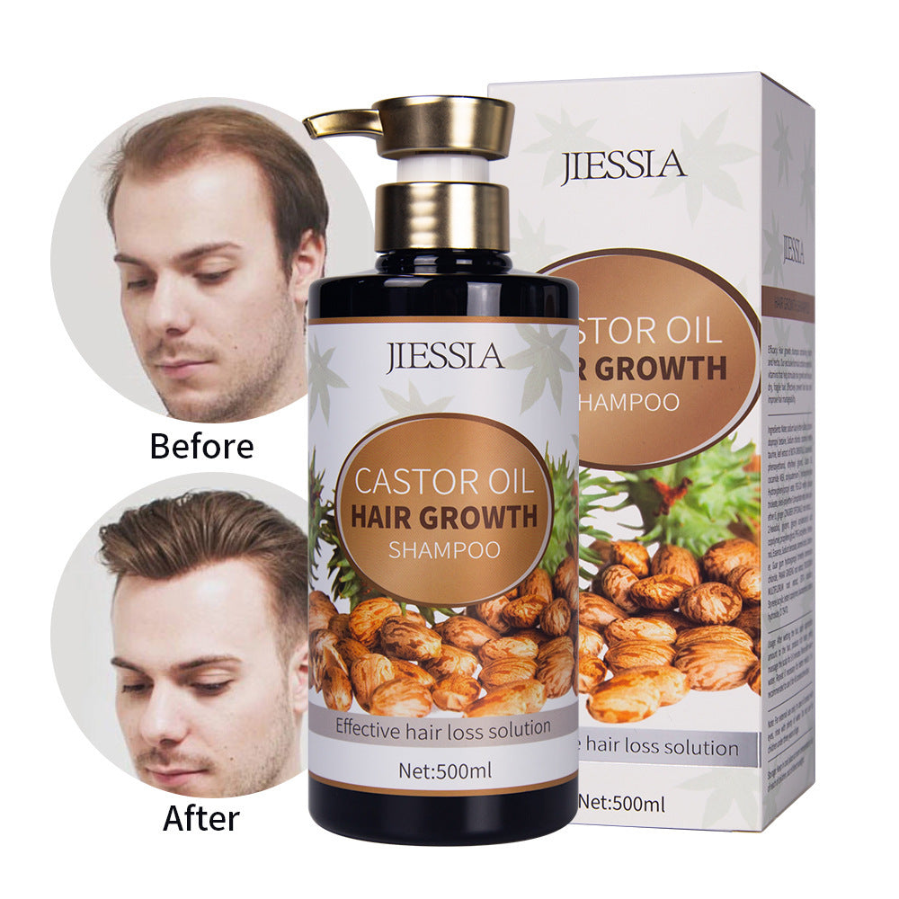 Improved Hair Loss Plant Nourishing Oil Control Castor Oil Shampoo